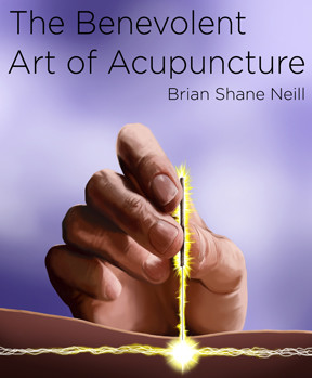 Acupuncture Dublin